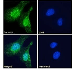 Immunofluorescence - Anti-DLC1 Antibody (A83189) - Antibodies.com