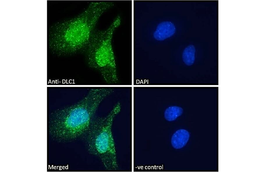 Immunofluorescence - Anti-DLC1 Antibody (A83189) - Antibodies.com