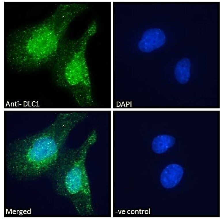 Immunofluorescence - Anti-DLC1 Antibody (A83189) - Antibodies.com