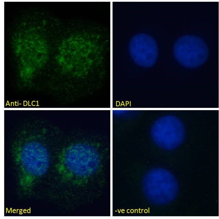 Immunofluorescence - Anti-DLC1 Antibody (A83189) - Antibodies.com