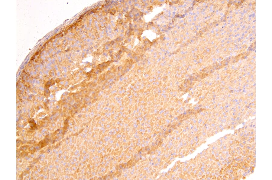 Immunohistochemistry - Anti-DLC1 Antibody (A83189) - Antibodies.com