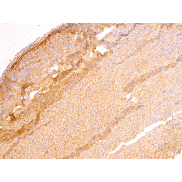 Immunohistochemistry - Anti-DLC1 Antibody (A83189) - Antibodies.com