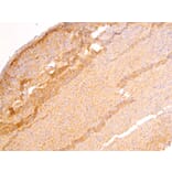 Immunohistochemistry - Anti-DLC1 Antibody (A83189) - Antibodies.com