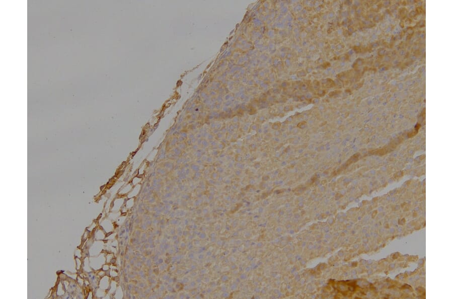 Immunohistochemistry - Anti-DLC1 Antibody (A83189) - Antibodies.com