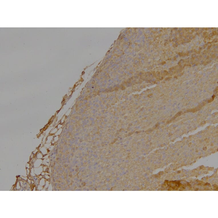 Immunohistochemistry - Anti-DLC1 Antibody (A83189) - Antibodies.com