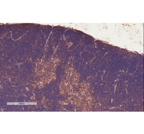 Immunohistochemistry - Anti-STAT3 Antibody (A83190) - Antibodies.com