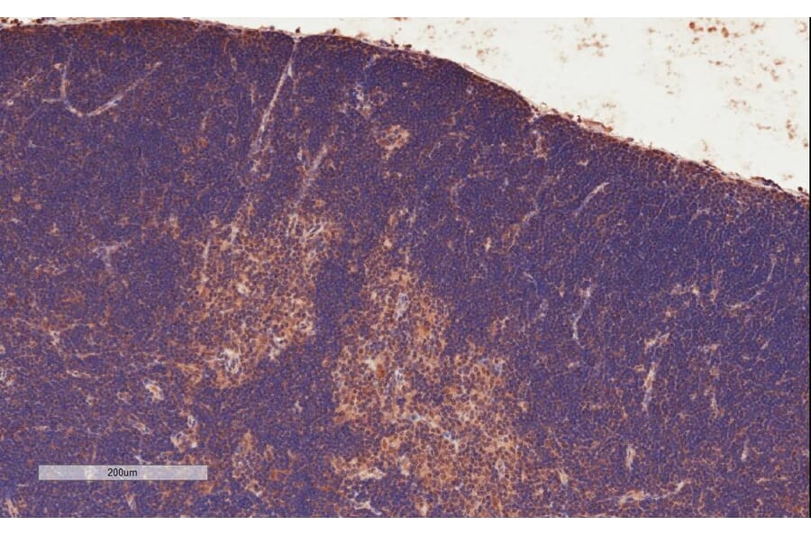 Immunohistochemistry - Anti-STAT3 Antibody (A83190) - Antibodies.com