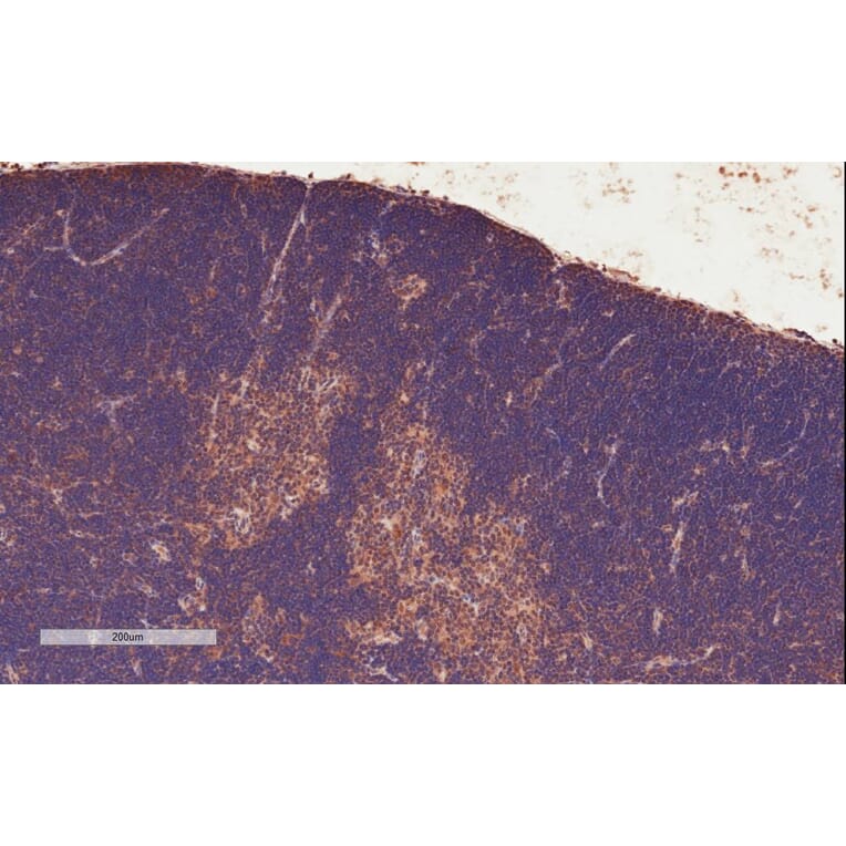 Immunohistochemistry - Anti-STAT3 Antibody (A83190) - Antibodies.com