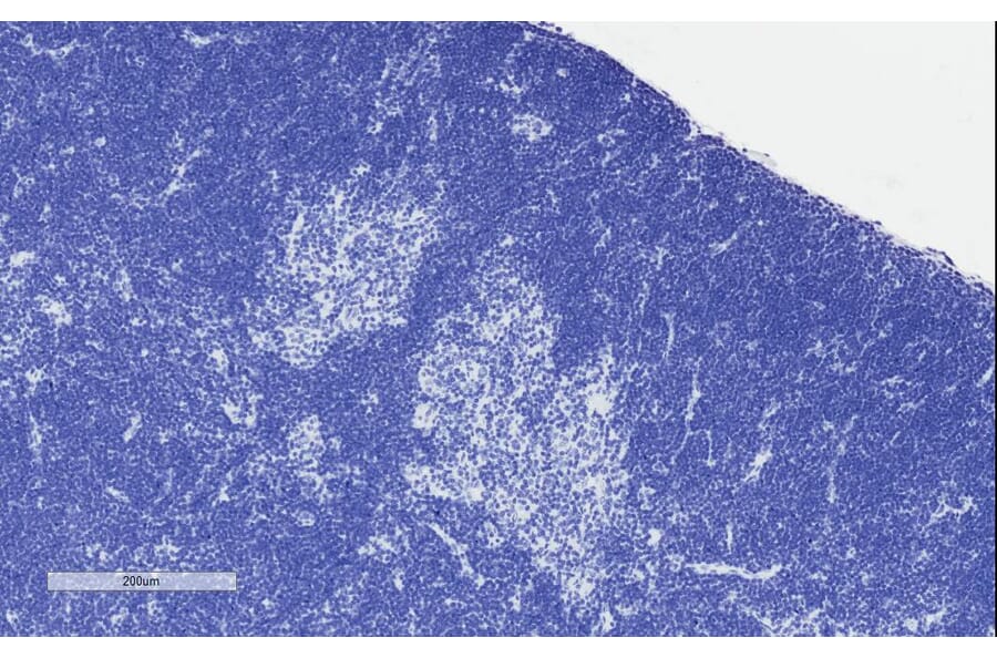 Immunohistochemistry - Anti-STAT3 Antibody (A83190) - Antibodies.com