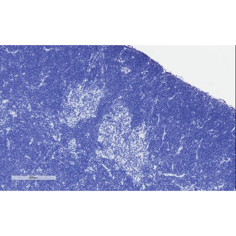 Immunohistochemistry - Anti-STAT3 Antibody (A83190) - Antibodies.com