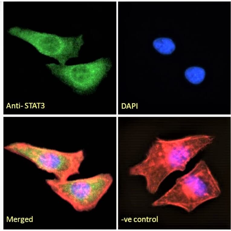 Immunofluorescence - Anti-STAT3 Antibody (A83190) - Antibodies.com