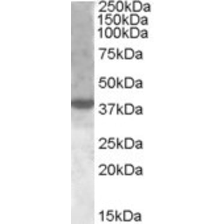 Western Blot - Anti-XBP1 Antibody (A83192) - Antibodies.com