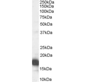 Western Blot - Anti-CDKN2A/p16INK4A Antibody (A83193) - Antibodies.com