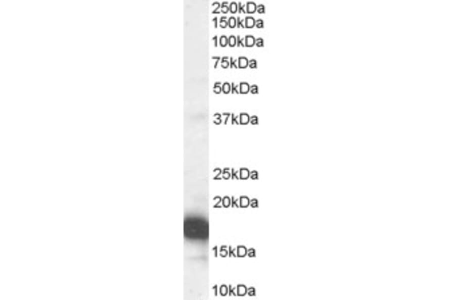 Western Blot - Anti-CDKN2A/p16INK4A Antibody (A83193) - Antibodies.com