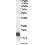 Western Blot - Anti-CDKN2A/p16INK4A Antibody (A83193) - Antibodies.com
