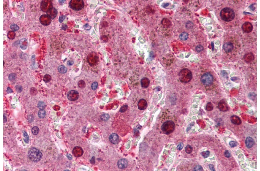 Immunohistochemistry - Anti-CDKN2A/p16INK4A Antibody (A83193) - Antibodies.com