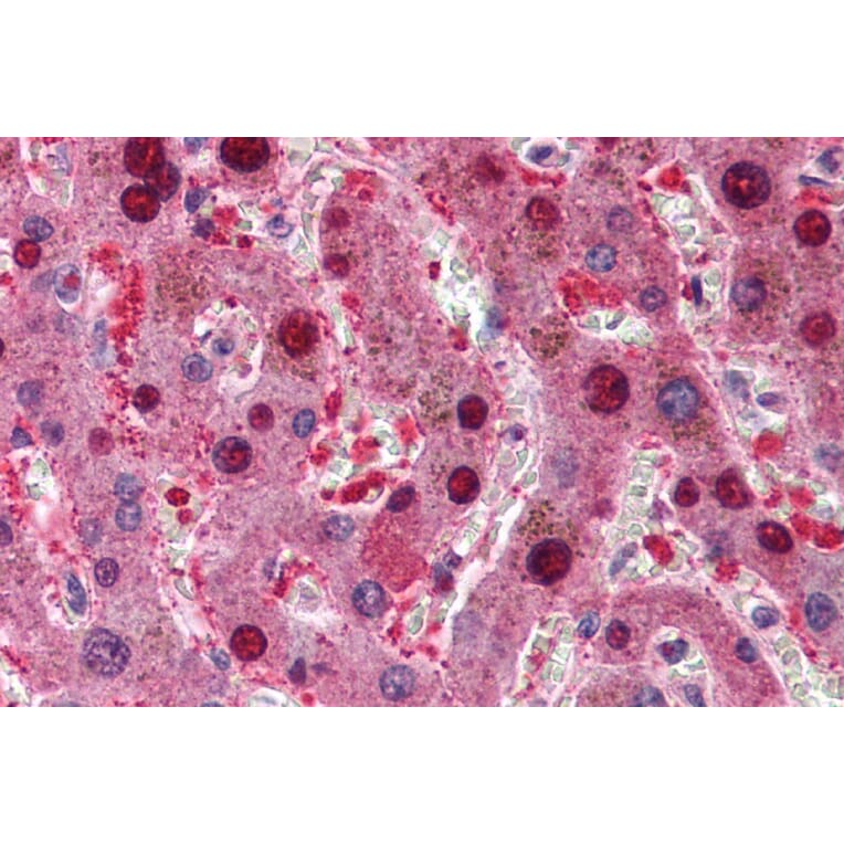 Immunohistochemistry - Anti-CDKN2A/p16INK4A Antibody (A83193) - Antibodies.com