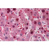Immunohistochemistry - Anti-CDKN2A/p16INK4A Antibody (A83193) - Antibodies.com