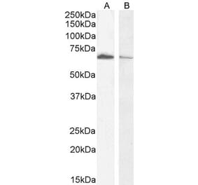 Western Blot - Anti-Acetylcholinesterase Antibody (A83194) - Antibodies.com