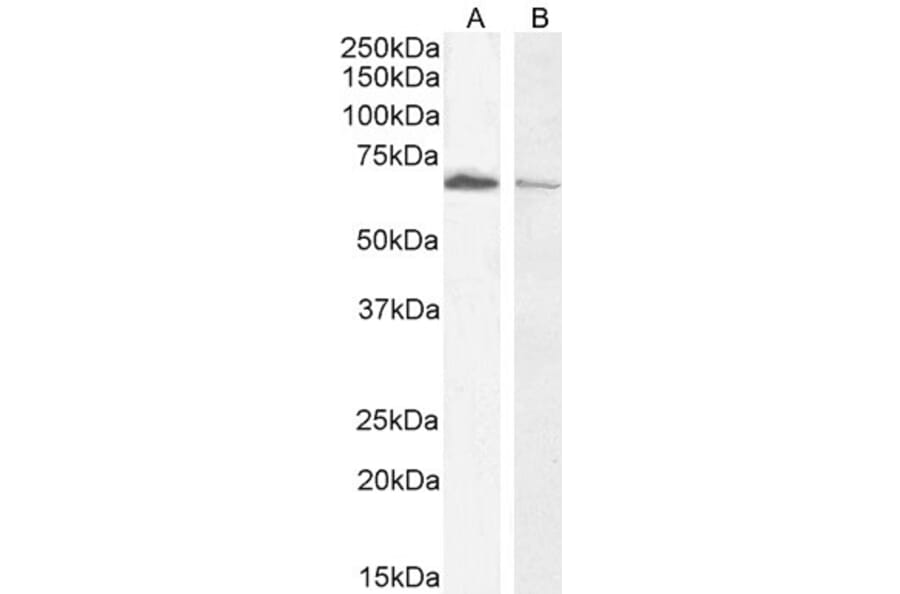 Western Blot - Anti-Acetylcholinesterase Antibody (A83194) - Antibodies.com