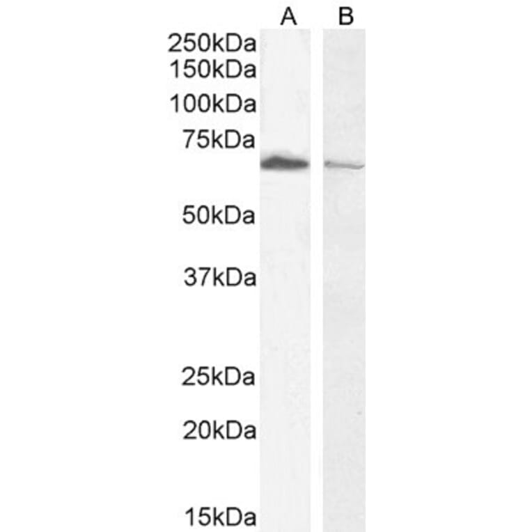 Western Blot - Anti-Acetylcholinesterase Antibody (A83194) - Antibodies.com