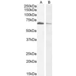 Western Blot - Anti-Acetylcholinesterase Antibody (A83194) - Antibodies.com