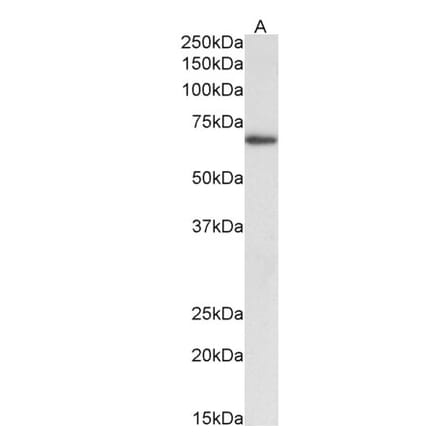 Western Blot - Anti-ACHE Antibody (A83194) - Antibodies.com