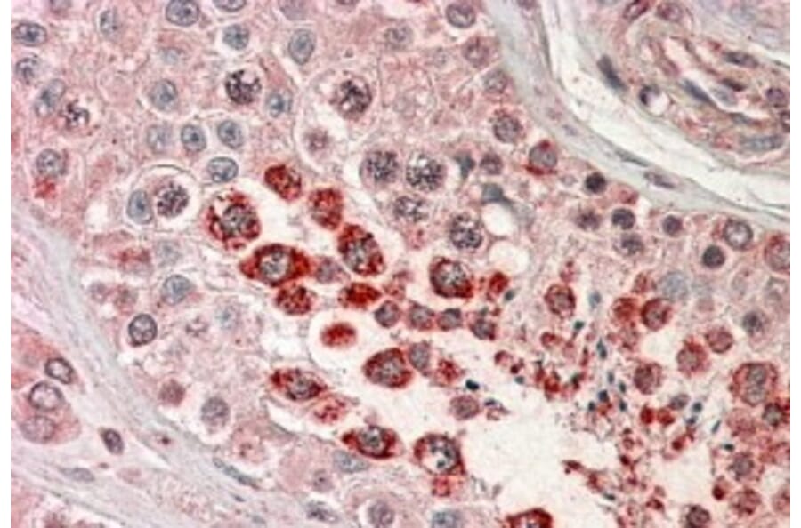 Immunohistochemistry - Anti-XAGE1 Antibody (A83195) - Antibodies.com