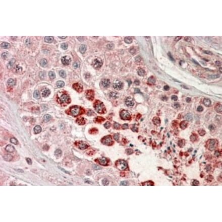 Immunohistochemistry - Anti-XAGE1 Antibody (A83195) - Antibodies.com