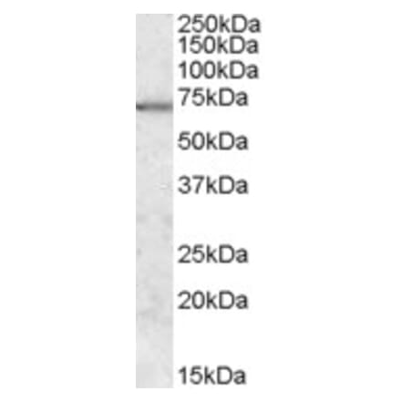 Western Blot - Anti-MARK2 Antibody (A83196) - Antibodies.com