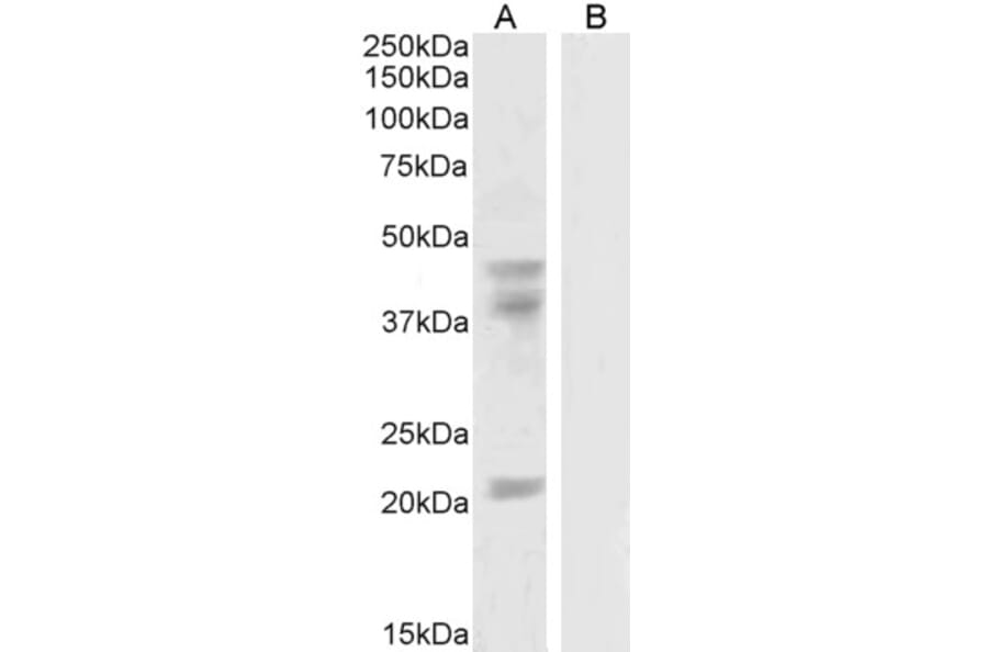 Western Blot - Anti-GABPB2/Nuclear Respiratory Factor 2 Antibody (A83197) - Antibodies.com