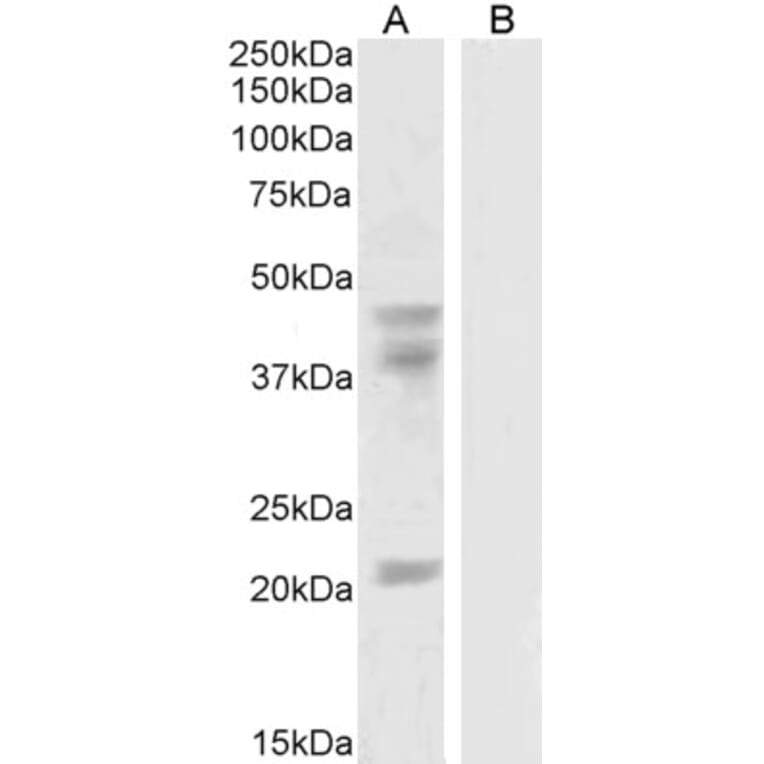 Western Blot - Anti-GABPB2/Nuclear Respiratory Factor 2 Antibody (A83197) - Antibodies.com