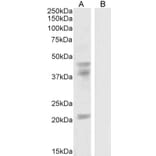 Western Blot - Anti-GABPB2/Nuclear Respiratory Factor 2 Antibody (A83197) - Antibodies.com