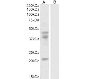 Western Blot - Anti-GABPB2 Antibody (A83197)