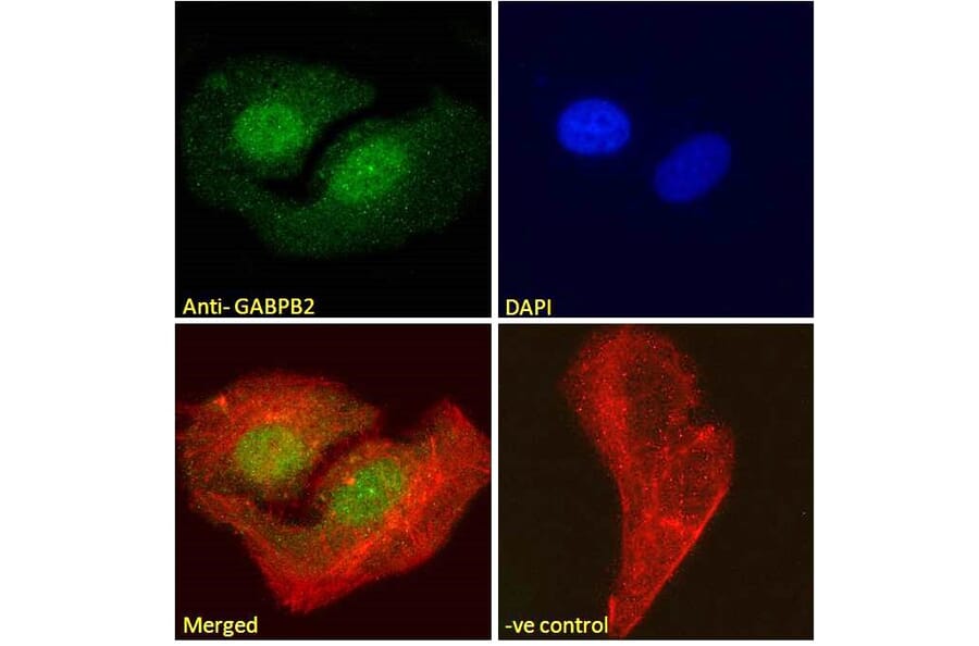 Immunofluorescence - Anti-GABPB2/Nuclear Respiratory Factor 2 Antibody (A83197) - Antibodies.com