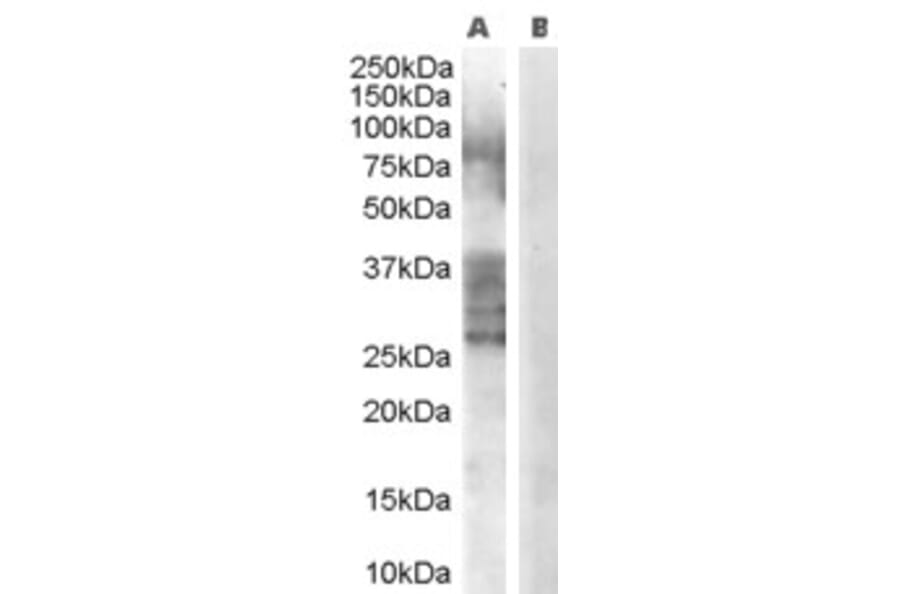 Western Blot - Anti-ADAM33 Antibody (A83199) - Antibodies.com