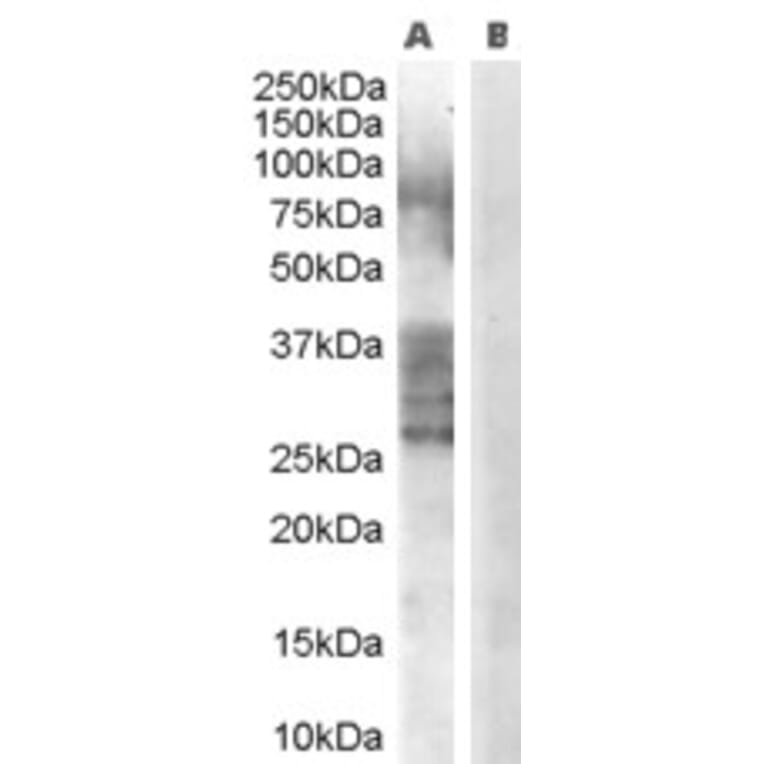 Western Blot - Anti-ADAM33 Antibody (A83199) - Antibodies.com