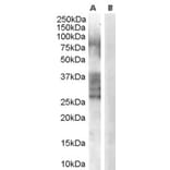 Western Blot - Anti-ADAM33 Antibody (A83199) - Antibodies.com