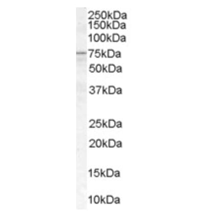 Western Blot - Anti-ACSL5 Antibody (A83201) - Antibodies.com