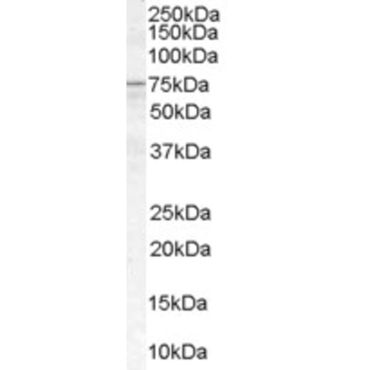 Western Blot - Anti-ACSL5 Antibody (A83201) - Antibodies.com