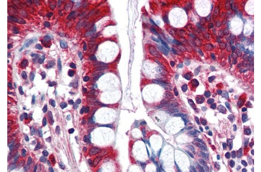Immunohistochemistry - Anti-ACSL5 Antibody (A83201) - Antibodies.com
