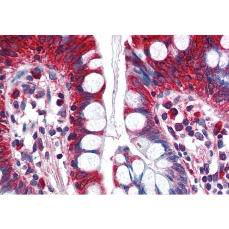 Immunohistochemistry - Anti-ACSL5 Antibody (A83201) - Antibodies.com