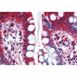 Immunohistochemistry - Anti-ACSL5 Antibody (A83201) - Antibodies.com