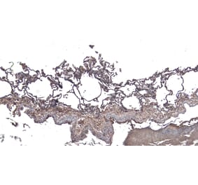 Immunohistochemistry - Anti-ARAP1 Antibody (A83202) - Antibodies.com