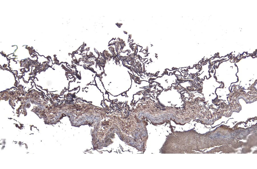 Immunohistochemistry - Anti-ARAP1 Antibody (A83202) - Antibodies.com