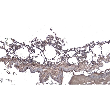 Immunohistochemistry - Anti-ARAP1 Antibody (A83202) - Antibodies.com