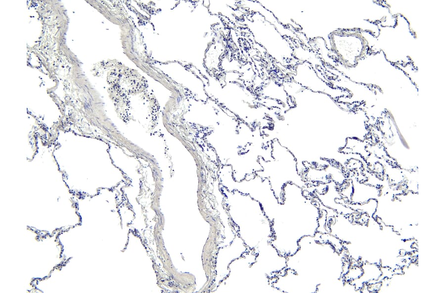 Immunohistochemistry - Anti-ARAP1 Antibody (A83202) - Antibodies.com