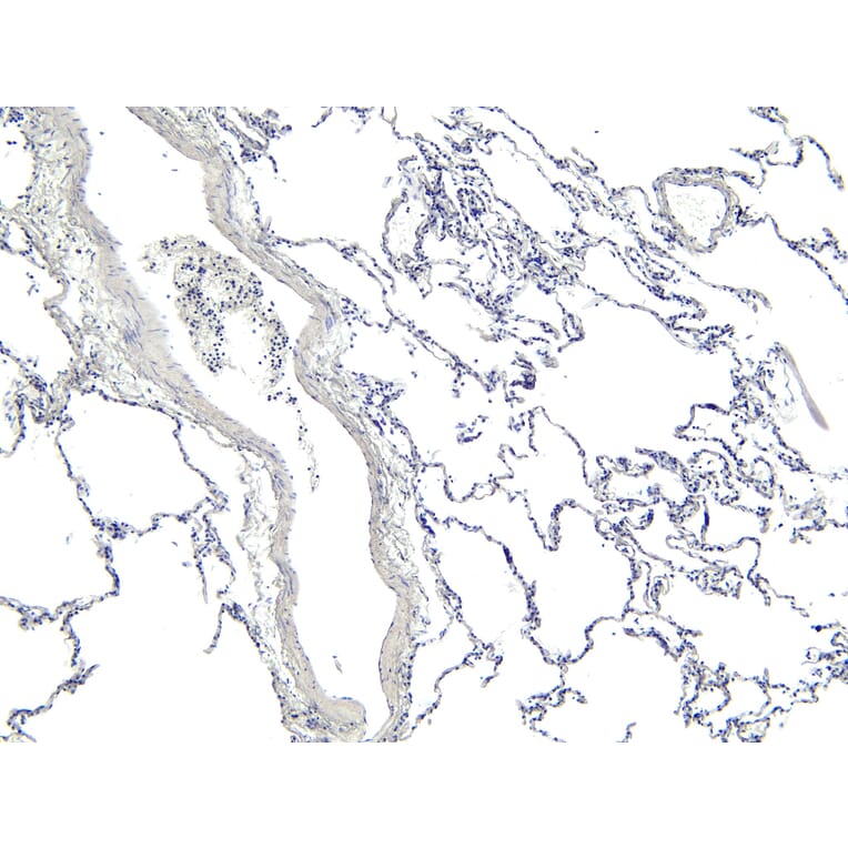 Immunohistochemistry - Anti-ARAP1 Antibody (A83202) - Antibodies.com