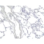 Immunohistochemistry - Anti-ARAP1 Antibody (A83202) - Antibodies.com