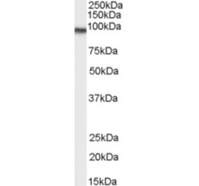 Western Blot - Anti-Transglutaminase 2 Antibody (A83205) - Antibodies.com